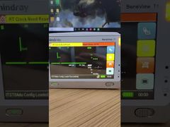 ببینید چرا صفحه نمایش LCD مانیتور بیمار Mindray BeneView T1 را با درب جلویی انتخاب کنید