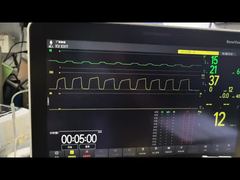 مشاهده ماژول Mindray AG AG And O2 Module MMS PN 115-023943-00 نسخه نمایشی