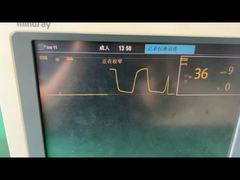 نگاهی دقیق تر: ماژول گاز بیهوشی کودکان Mindray Trap For 9200-10-10530 بزرگسالان